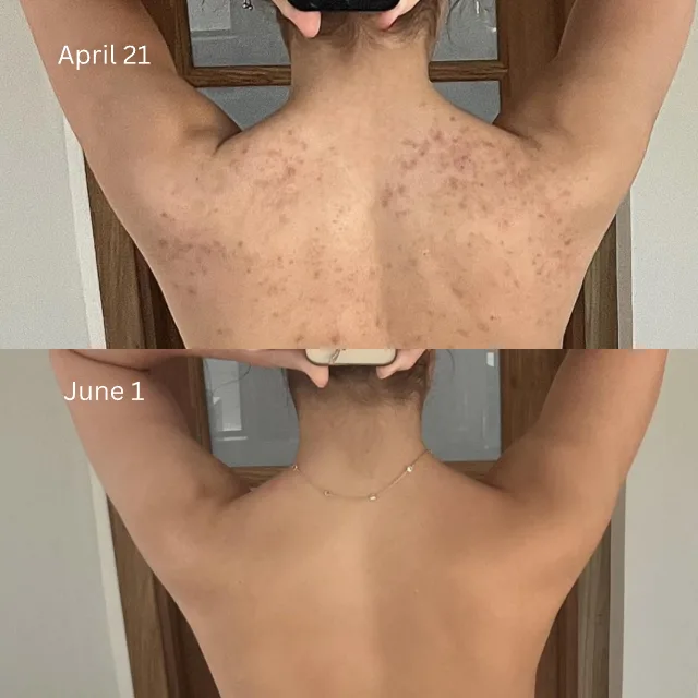 Kate's back on April 21 and on June 1